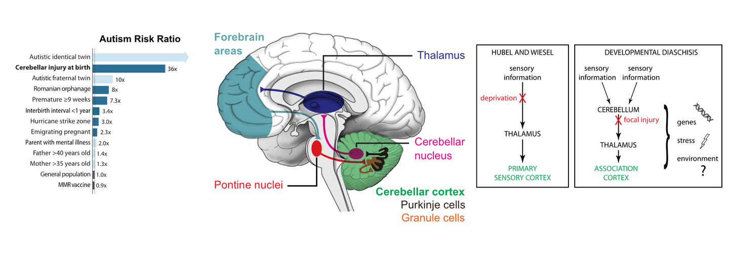 The cerebellum and autism